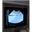 ATL Ultramark 4 Plus Ultrasound Imaging System 8500-0028-01 w/Access 10 Scanhead